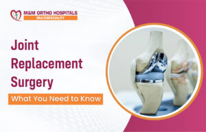 Read more about the article Joint Replacement Surgery: What You Need to Know 