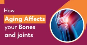 Read more about the article 𝐇𝐨𝐰 𝐀𝐠𝐢𝐧𝐠 𝐀𝐟𝐟𝐞𝐜𝐭𝐬 𝐘𝐨𝐮𝐫 𝐁𝐨𝐧𝐞𝐬 𝐚𝐧𝐝 𝐉𝐨𝐢𝐧𝐭𝐬