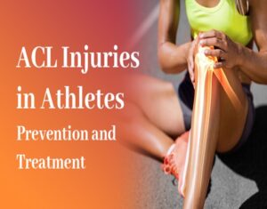 Read more about the article ACL Injuries in Athletes: Prevention and Treatment