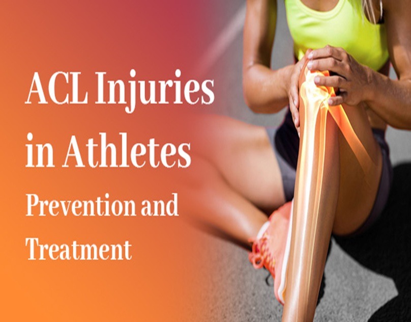 ACL Injuries in Athletes: Prevention and Treatment