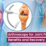 Arthroscopy for Joint Problems: Benefits and Recovery