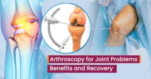 Read more about the article Arthroscopy for Joint Problems: Benefits and Recovery