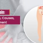 Sciatica Pain: Symptoms, Causes, and Treatment