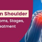 Frozen Shoulder: Symptoms, Stages, and Treatment