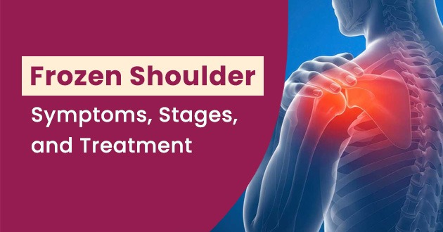 Frozen Shoulder: Symptoms, Stages, and Treatment