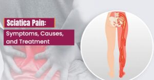 Read more about the article Sciatica Pain: Symptoms, Causes, and Treatment