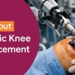 All About Robotic Knee Replacement