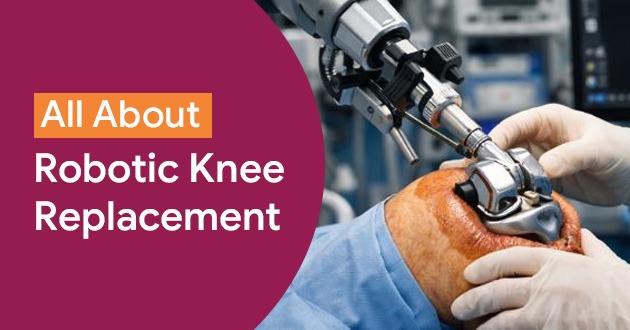 All About Robotic Knee Replacement