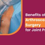 Benefits of Arthroscopic Surgery for Joint Problems