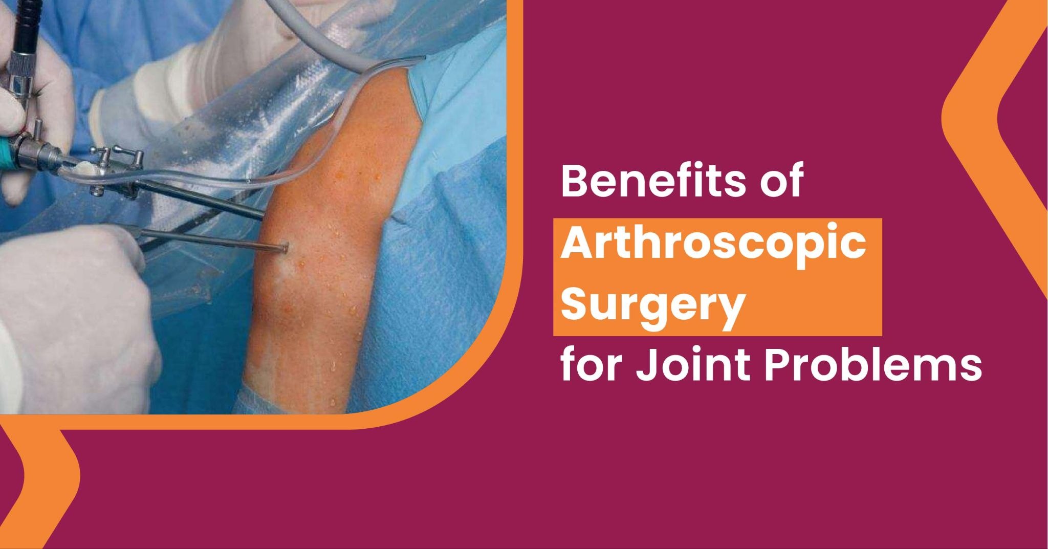 Benefits of Arthroscopic Surgery for Joint Problems
