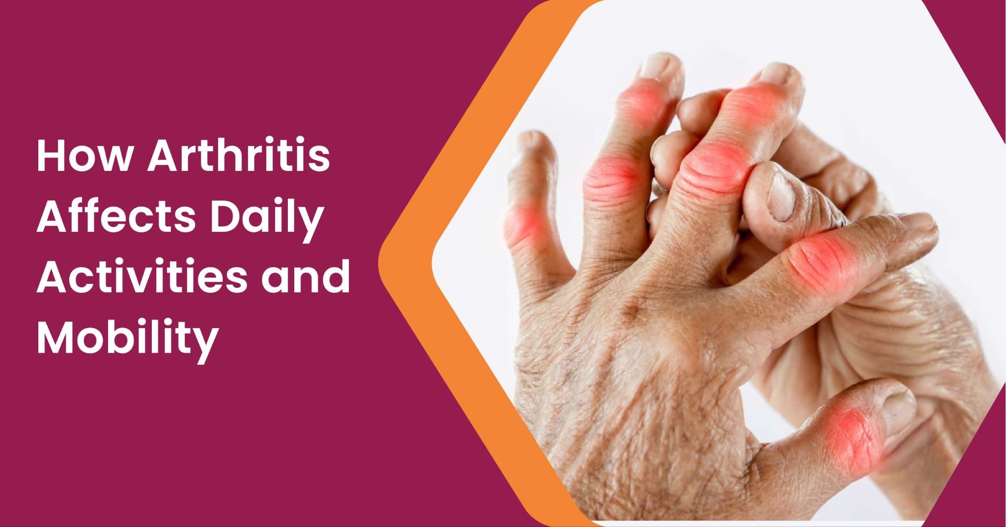 How Arthritis Affects Daily Activities and Mobility