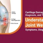 Cartilage Damage: Symptoms, Diagnosis, and Treatment