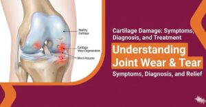 Read more about the article Cartilage Damage: Symptoms, Diagnosis, and Treatment